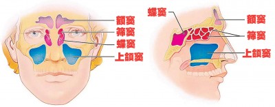 图解鼻窦部位